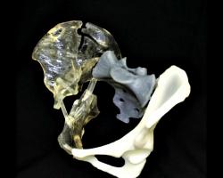 Axial3D爭做專業(yè)醫(yī)療3D打印模型領(lǐng)頭羊